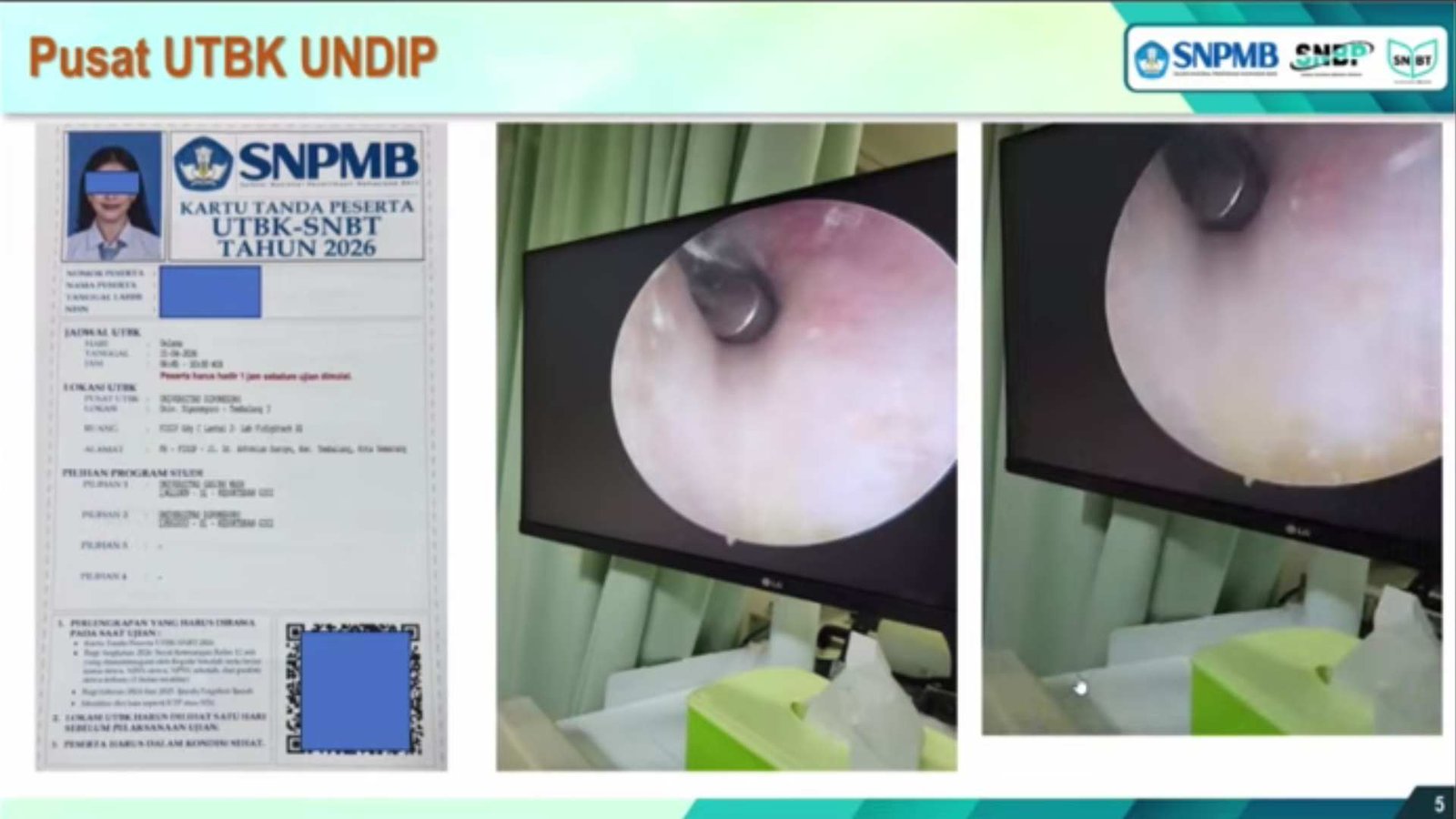 Kecurangan UTBK 2026